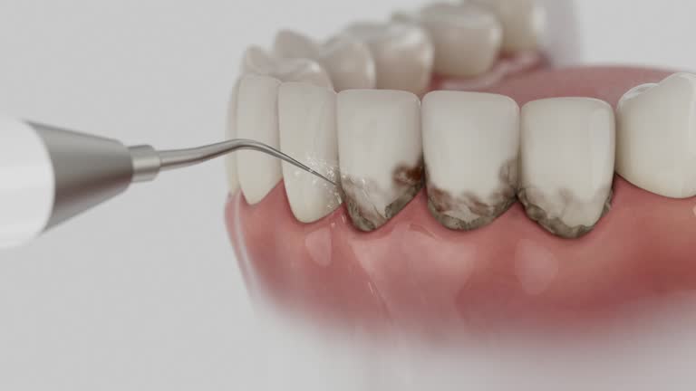 Reliable Tooth Extraction contractor in Joplin, MO by Smile Center Dentistry